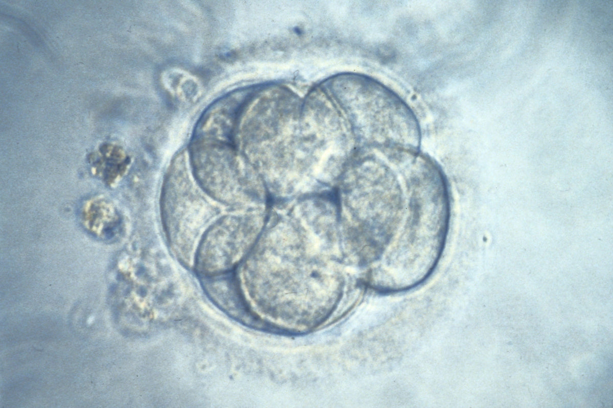 An eight-cell human embryo grown by IVF.